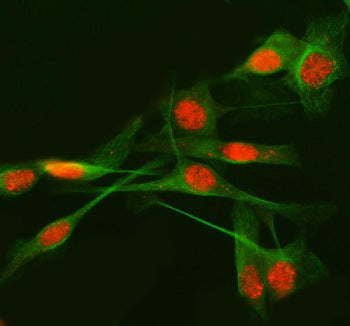 Immunofluorescent staining of METTL17 using anti-METTL17 antibody (red) and anti-Beta Tubulin antibody (green). METTL17 was detected in immunocytochemical section of HELA cell. Enzyme antigen retrieval was performed using IHC enzyme antigen retrieval reagent for 15 mins. The cells were blocked with 10% goat serum. And then incubated with 5 ug/ml rabbit anti-METTL17 antibody and mouse anti-Beta Tubulin antibody overnight at 4oC.