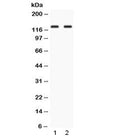Western blot testing of 1) rat testis and 2) human HepG2 lysate with LRIG3 antibody at 0.5ug/ml. Observed molecular weight: ~123 kDa (precursor), 140-170 kDa (glycosylated).