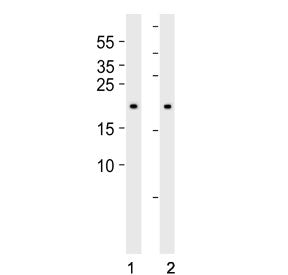 Western blot testing of human 1) 293 and 2) HT-1080 cell lysate with BAX antibody. Predicted molecular weight ~21 kDa.