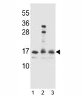 HOPX antibody western blot analysis in 1) Ramos, 2) A2058 and 3) 293 lysate.