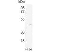 Western blot testing of 1) non-transfected and 2) transfected 293 cell lysate with Alcohol dehydrogenase 4 antibody. Predicted molecular weight ~40 kDa.