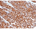 IHC staining of FFPE human stomach tissue with recombinant Cadherin 1 antibody (clone rCDH1/6769). HIER: boil tissue sections in pH 9 10mM Tris with 1mM EDTA for 20 min and allow to cool before testing.