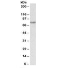 Western blot testing of HeLa lysate with CRTC2 antibody at 1ug/ml. Predicted molecular weight: ~73 kDa.