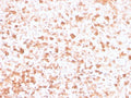 IHC staining of FFPE human tonsil with recombinant Lambda Light Chain antibody (clone rLLC/3777). HIER: boil tissue sections in pH 9 10mM Tris with 1mM EDTA for 20 min and allow to cool before testing.