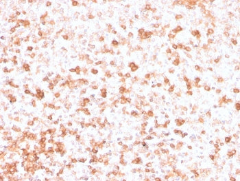 IHC staining of FFPE human tonsil with recombinant Lambda Light Chain antibody (clone rLLC/3777). HIER: boil tissue sections in pH 9 10mM Tris with 1mM EDTA for 20 min and allow to cool before testing.