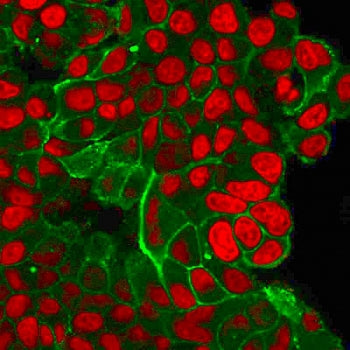 Immunofluorescent staining of PFA-fixed human MCF7 cells with HER2 antibody (clone ERBB2/2452, green) and Reddot nuclear stain (red).