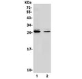 Western blot testing of 1) rat brain and 2) mouse brain lysate with 14-3-3 gamma antibody. Predicted molecular weight ~28 kDa.