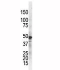 The IKK gamma antibody used in western blot to detect IKKg in ZR75-1 cell lysate. Predicted molecular weight ~48 kDa.