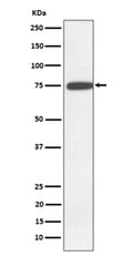 Western blot analysis of GNE expression in K562 cell lysate using GNE antibody. Predicted molecular weight: 67-83 kDa (multiple isoforms).