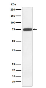Western blot analysis of GNE expression in K562 cell lysate using GNE antibody. Predicted molecular weight: 67-83 kDa (multiple isoforms).