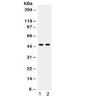 Western blot testing of 1) human HeLa and 2) mouse HEPA1-6 cell lysate with AT1R antibody. Observed molecular weight ~41-50 kDa depending on glycosylation level.