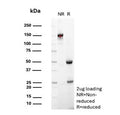 SDS-PAGE analysis of purified, BSA-free MUC18 antibody (clone OJ79c) as confirmation of integrity and purity.