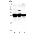 Western blot testing of 1) rat liver, 2) mouse liver and 3) mouse HEPA1-6 lysate with MBL2 antibody at 0.5ug/ml. Predicted molecular weight ~26 kDa.