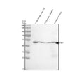 Western blot analysis of Yb-1 protein using Zebrafish Yb-1 antibody and 1) whole female zebrafish, 2) whole male zebrafish and 3) zebrafish embryo tissue lysate. Predicted molecular weight ~35 kDa.