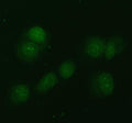 Immunofluorescent staining of FFPE human T-47D cells with NDRG2 antibody (green). HIER: steam section in pH6 citrate buffer for 20 min.