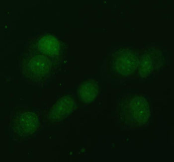 Immunofluorescent staining of FFPE human T-47D cells with NDRG2 antibody (green). HIER: steam section in pH6 citrate buffer for 20 min.