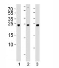 Western blot analysis of lysate from 1) 293, 2) SW620, and 3) U-87 MG cell line using UCHL3 antibody at 1:1000. Predicted molecular weight ~26 kDa.