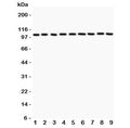 Western blot testing of alpha Catenin antibody and Lane 1: rat liver; 2: (r) lung; 3: (r) heart; 4: mouse NIH3T3; 5: (r) PC12; 6: human HEPG2; 7: (h) HeLa; 8: (h) MCF-7; 9: (m) HEPA. Expected/observed molecular weight: ~102 kDa.