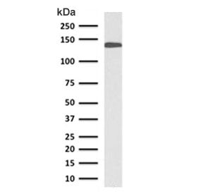 Western blot testing of human small intestine lysate with CDH17 antibody (clone CDN17-1). Predicted molecular weight ~92 kDa but may be observed at higher molecular weights due to glycosylation.