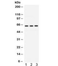 Western blot testing of human 1) HeLa, 2) Jurkat and 3) HUT lysate with EME1 antibody. Expected molecular weight ~63 kDa.