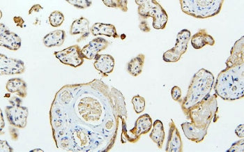 IHC staining of FFPE human placenta with MID1 antibody. HIER: boil tissue sections in pH6, 10mM citrate buffer, for 20 min and allow to cool before testing.