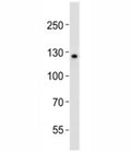 Western blot analysis of lysate from K562 cell line using LIFR antibody diluted at 1:1000. Expected/observed molecular weight ~124/190kDa (unmodified/glycosylated).