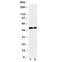 Western blot testing of NOXA1 antibody and Lane 1: U87; 2: HeLa cell lysate. Predicted/observed molecular weight ~51 kDa.