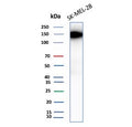 Western blot testing of human SK-MEL-28 cell lysate with Biliary glycoprotein 1 antibody (clone CEACAM1/12665). Predicted molecular weight ~58 kDa but may be observed at higher molecular weights due to heavy glycosylation.