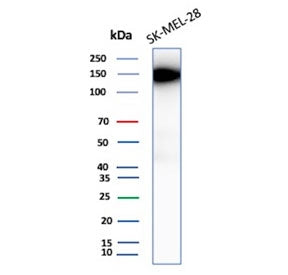 Western blot testing of human SK-MEL-28 cell lysate with Biliary glycoprotein 1 antibody (clone CEACAM1/12665). Predicted molecular weight ~58 kDa but may be observed at higher molecular weights due to heavy glycosylation.