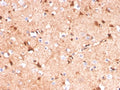 IHC staining of FFPE human cerebellum tissue with S100B antibody (clone S100B/4141). HIER: boil tissue sections in pH 9 10mM Tris with 1mM EDTA for 20 min and allow to cool before testing.
