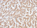 IHC staining of FFPE human liver with Complement C1q A-Chain antibody (clone C1QA/2952). HIER: boil tissue sections in pH 9 10mM Tris with 1mM EDTA for 10-20 min and allow to cool before testing.