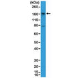 Western blot testing of human HepG2 cell lysate with recombinant CD13 antibody at 1:2000 dilution. Expected molecular weight: 110-150 kDa depending on glycosylation level.