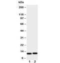 Western blot testing of GRO alpha antibody and human samples: 1) HeLa and 2) Jurkat cell lysate. Predicted molecular weight ~11 kDa.