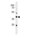 Abi3 antibody western blot analysis in mouse liver tissue lysate. Predicted molecular weight ~39 kDa.