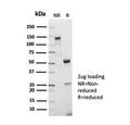 SDS-PAGE analysis of purified recombinant CD5 antibody (clone C5/7020R) as confirmation of integrity and purity.