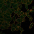IHC staining of FFPE human thyroid tissue with UBR2 antibody (clone PCRP-UBR2-1D12) at 2ug/ml. HIER: boil tissue sections in pH 9 10mM Tris with 1mM EDTA for 20 min and allow to cool before testing.