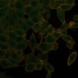 IHC staining of FFPE human thyroid tissue with UBR2 antibody (clone PCRP-UBR2-1D12) at 2ug/ml. HIER: boil tissue sections in pH 9 10mM Tris with 1mM EDTA for 20 min and allow to cool before testing.