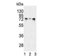 Western blot testing of human 1) HeLa, 2) A2058 and 3) NCI-H460 cell lysate with HSPA5 antibody. Predicted molecular weight: ~73 kDa, but routinely observed at 70-78 kDa.