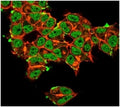 Immunofluorescent staining of PFA-fixed human MCF-7 cells Superoxide Dismutase 1 antibody (green, clone SOD1/3923) and phalloidin (red).