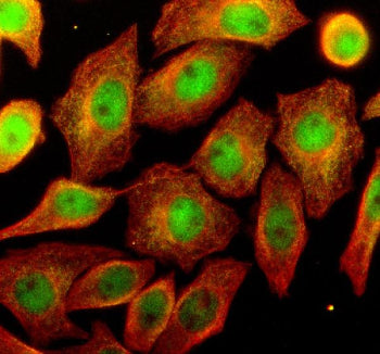 Immunofluorescent staining of OSTM1 using anti-OSTM1 antibody (green) and anti-Beta Tubulin antibody (red). OSTM1 was detected in an immunocytochemical section of human SIHA cells. Enzyme antigen retrieval was performed using IHC enzyme antigen retrieval reagent for 15 mins. The cells were blocked with 10% goat serum. And then incubated with 5 ug/ml rabbit anti-OSTM1 antibody and mouse anti-Beta Tubulin antibody overnight at 4oC.