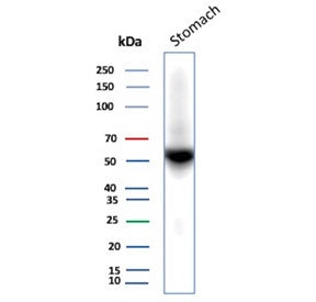Western blot testing of human stomach tissue lysate with recombinant CA9 antibody (clone rCA9/9937). Predicted molecular weight: 50-55 kDa but may be observed at higher molecular weights due to glycosylation.