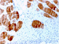 IHC staining of FFPE human skeletal muscle tissue with ACTN2 antibody. HIER: boil tissue sections in pH 9 10mM Tris with 1mM EDTA for 10-20 min and allow to cool before testing.
