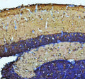 IHC staining of FFPE zebrafish brain tissue with Zebrafish Atp6v1b2 antibody, HRP secondary and DAB substrate. HIER: boil tissue sections in pH8 EDTA for 20 min and allow to cool before testing.