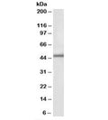 Western blot testing of human kidney lysate with IP6K3 antibody at 1ug/ml. Predicted/observed molecular weight: ~46kDa.