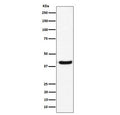 Western blot testing of human U-87 MG cell lysate with GNAI2 antibody. Predicted molecular weight ~40 kDa.