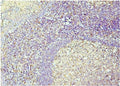 IHC staining of FFPE human tonsil with Caspase 3 antibody. HIER: boil tissue sections in pH8 EDTA for 20 min and allow to cool before testing.