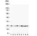 Western blot testing of Bax antibody and Lane 1: rat testis; 2: rat kidney; 3: (r) brain; 4: (r) ovary; 5: human HeLa; 6: (h) MM231; 7: (h) A549; 8: (h) Jurkat; 9: (h) placenta tissue lysate. Predicted molecular weight: 21-24 kDa.