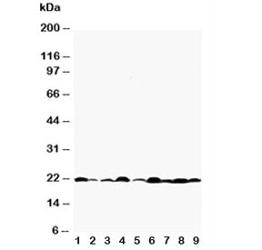 Western blot testing of Bax antibody and Lane 1: rat testis; 2: rat kidney; 3: (r) brain; 4: (r) ovary; 5: human HeLa; 6: (h) MM231; 7: (h) A549; 8: (h) Jurkat; 9: (h) placenta tissue lysate. Predicted molecular weight: 21-24 kDa.