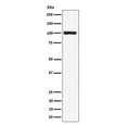 Western blot testing of human HeLa cell lysate with NCL antibody. Predicted molecular weight ~77 kDa, commonly observed at 100~110 kDa.