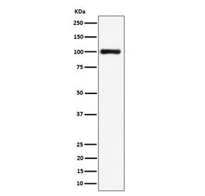 Western blot testing of human HeLa cell lysate with NCL antibody. Predicted molecular weight ~77 kDa, commonly observed at 100~110 kDa.